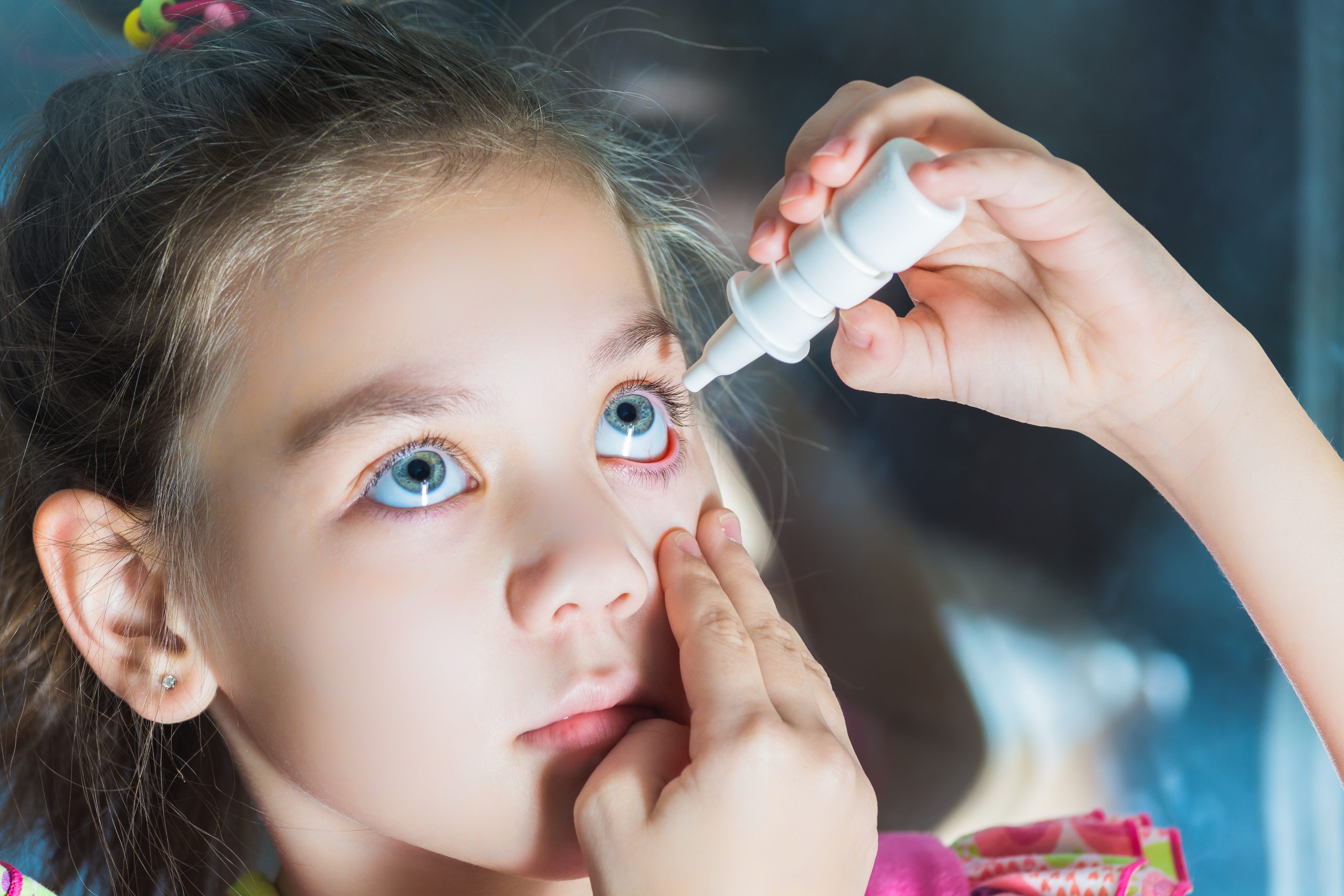 How to Treat Your Child's Eye Infection Gulf Coast Vision Center